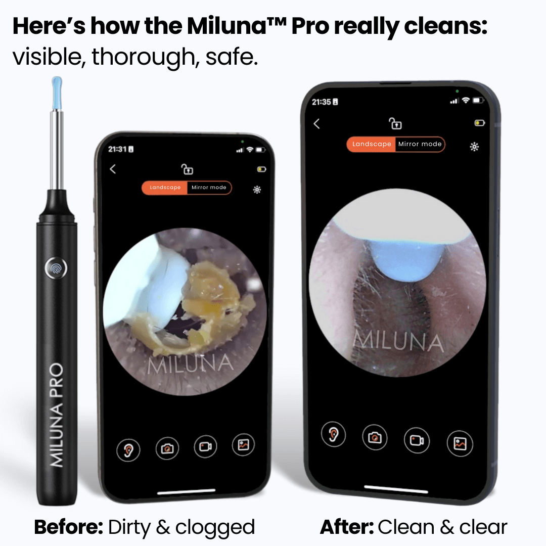 Miluna™ Pro